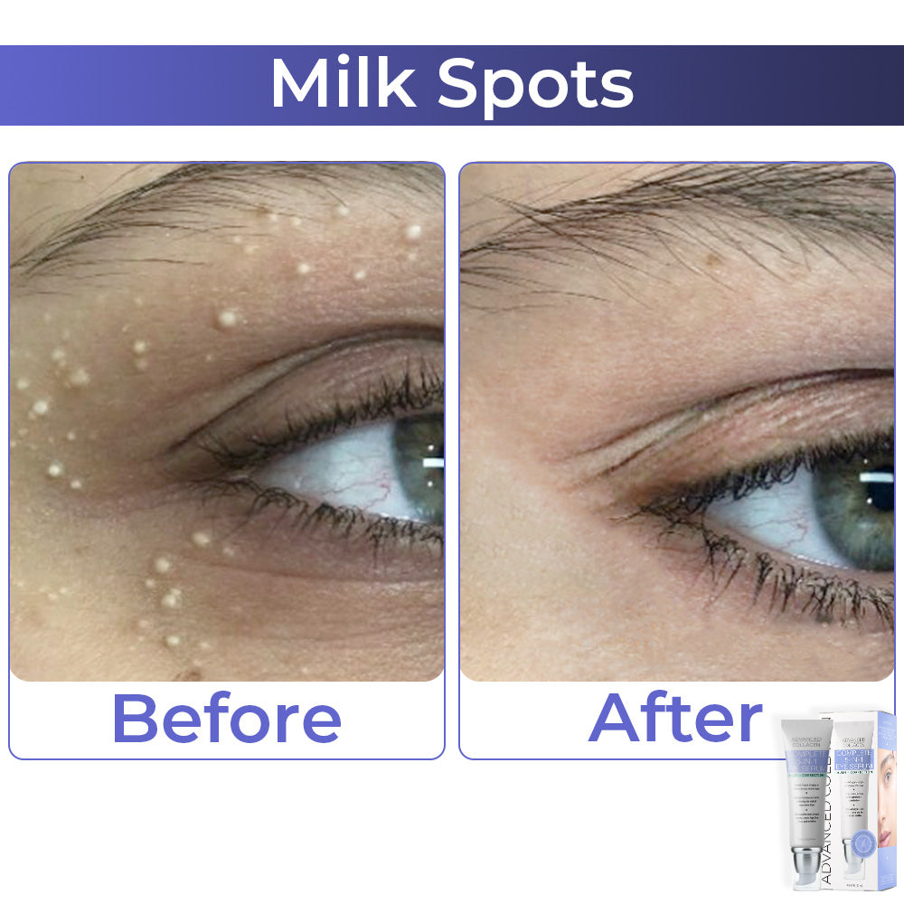 JEREMYTIS™ Advanced Collagen Complete Eye Cream