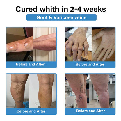 🔥80% OFF - Official Flagship Store: ODALIT™ Nano Microneedle Joint Patch