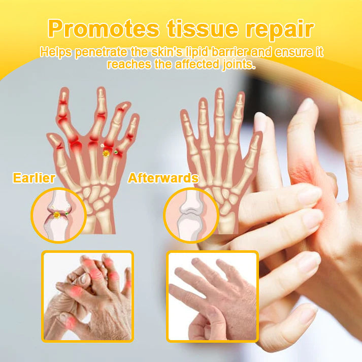 🔥Time-Limited Offer - ODALIT™ Botulinum Toxin & Bee Venom Pain-Relief Bone Healing Cream🐝💎