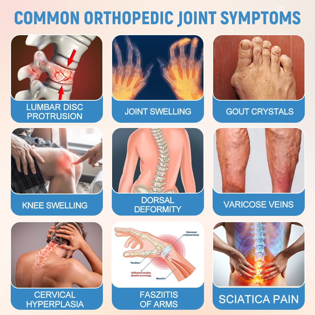 ✅Official Store：👩‍⚕️Recommended by AAOS🦾ODALIT™ Nano-microneedle joint patch