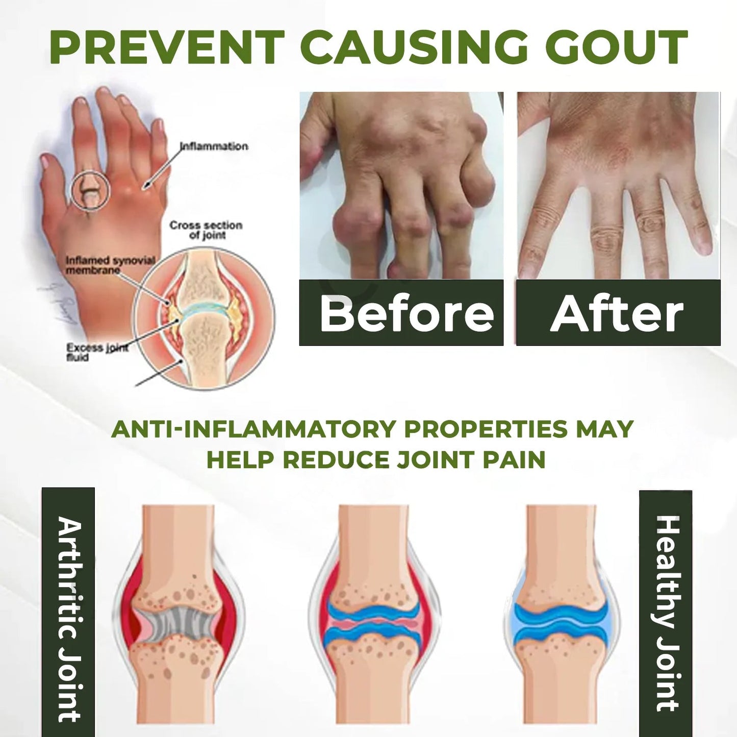 🔥ODALIT™ SNAKE PEPTIDE 3X Instant Joint Pain Relief Gel 🐍💎