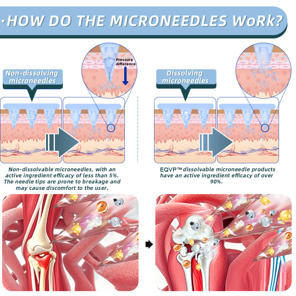 ✅Official Store：👩‍⚕️Recommended by AAOS🦾ODALIT™ Nano-microneedle joint patch
