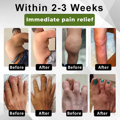 🔥ODALIT™ SNAKE PEPTIDE 3X Instant Joint Pain Relief Gel 🐍💎