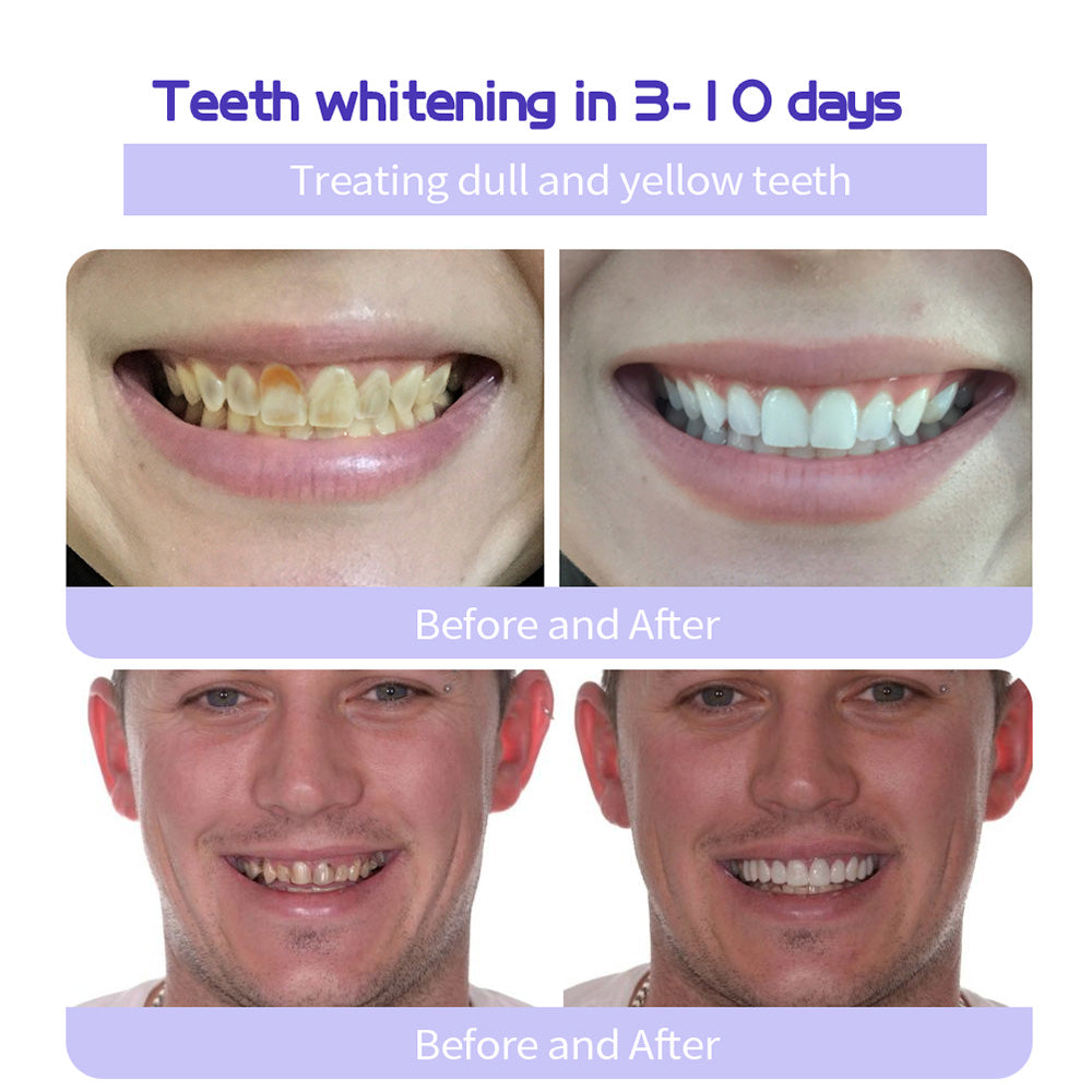 NEGUSY™ Teeth Restoration Mineral Powder🦷(TGA recommended)(🎁Flash Sale - Don’t Miss Out)