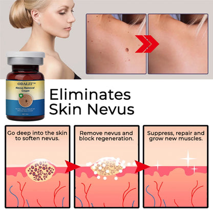 ✅Official Store:ODALIT™ Nevus Removal Cream