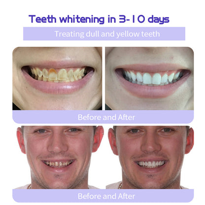 ODALIT™ Teeth Restoration Mineral Powder🦷(🎁Flash Sale - Don’t Miss Out)