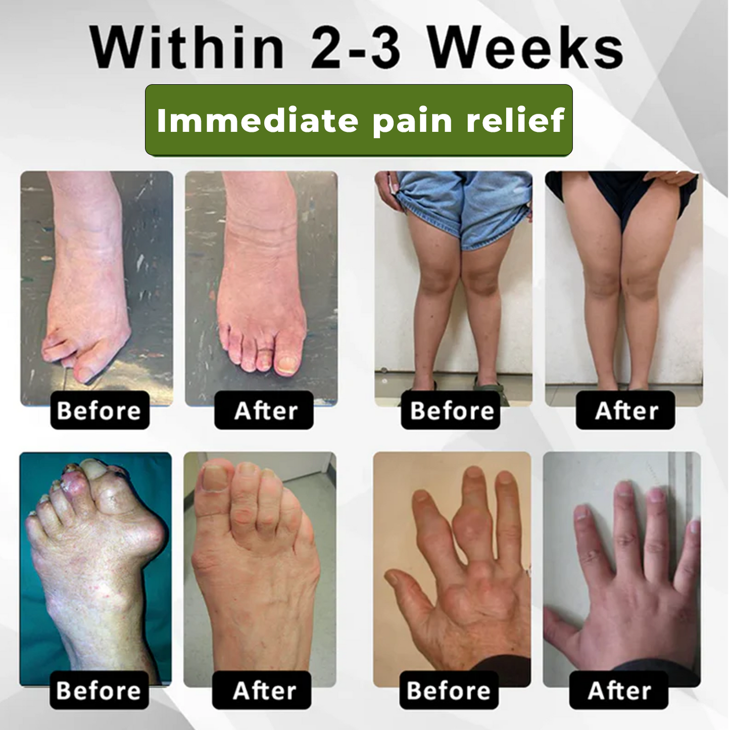 🔥ODALIT™ SNAKE PEPTIDE 3X Instant Joint Pain Relief Gel 🐍💎