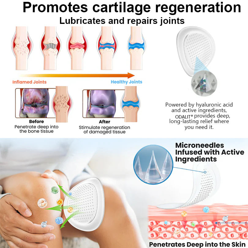 🔥80% OFF - Official Flagship Store: ODALIT™ Nano Microneedle Joint Patch
