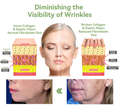 ✅FDA Approval💝JEREMYTIS™ Luxurious Collagen Peptide Firming Cream🔥Limited-Time 70% Off!🔥