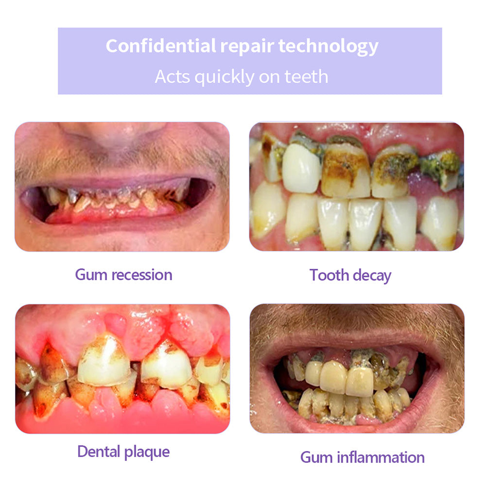 NEGUSY™ Teeth Restoration Mineral Powder🦷(TGA recommended)(🎁Flash Sale - Don’t Miss Out)