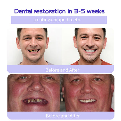 NEGUSY™ Teeth Restoration Mineral Powder🦷(TGA recommended)(🎁Flash Sale - Don’t Miss Out)