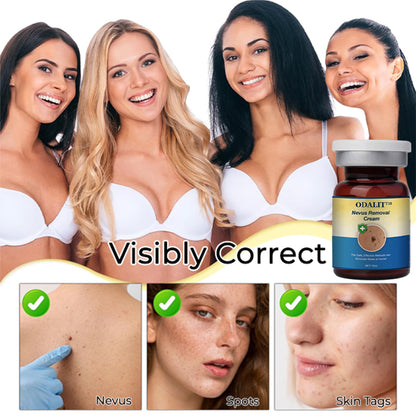 ✅Official Store:ODALIT™ Nevus Removal Cream