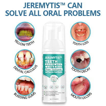 JEREMYTIS™Toothpaste Mousse Foam, Calculus Removal, Teeth Whitening, Healing Mouth Ulcers, Eliminating Bad Breath, Preventing and Healing Caries, Tooth Regeneration