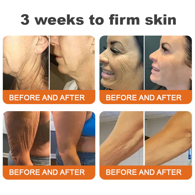 🐝🎁Made and Shipped from Australia✨ODALIT™ Botulinum Toxin Bee Poison Firming Serum Stick🔥LAST DAY 70% OFF
