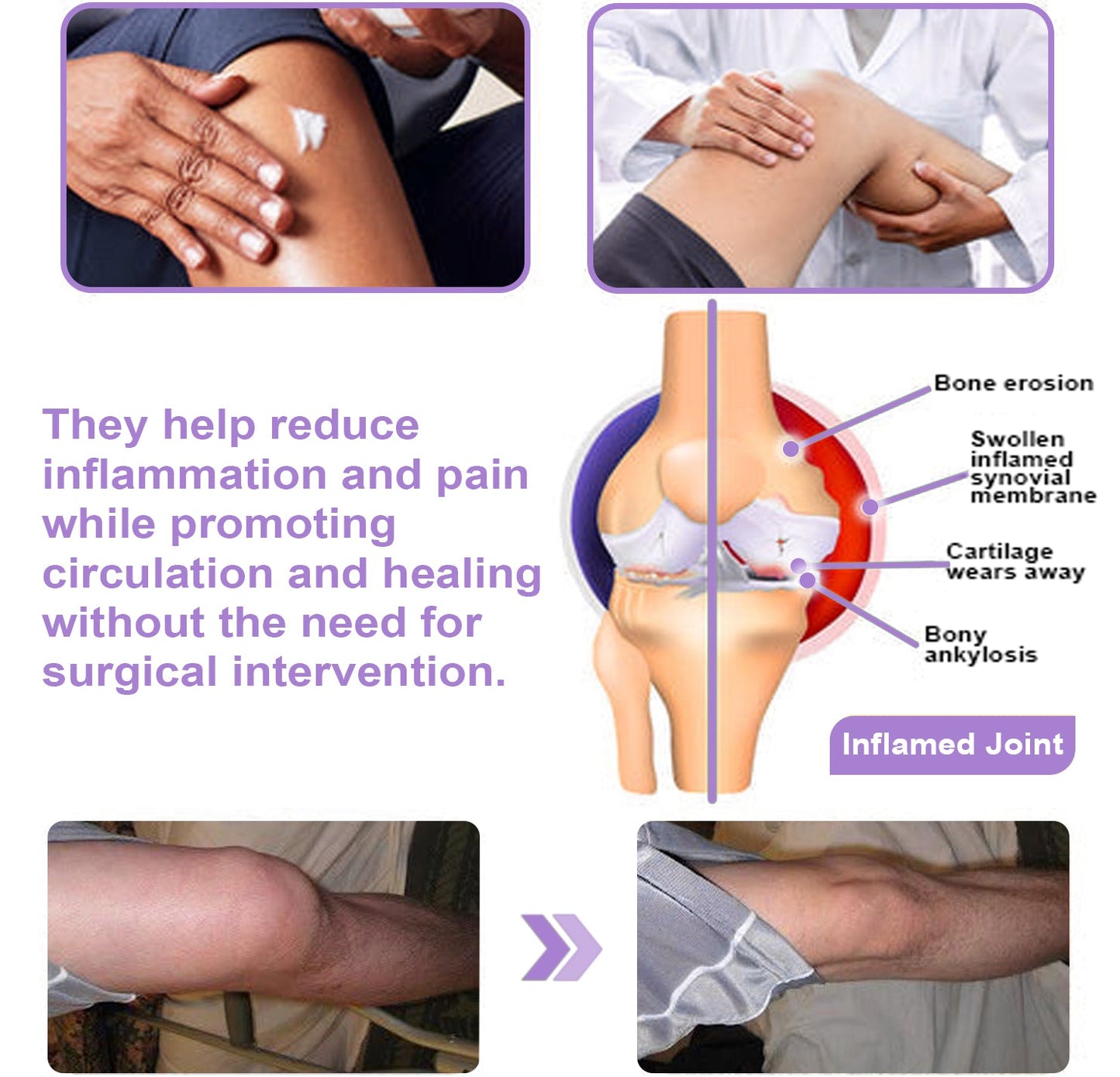 ODALIT™ Arthritis Pain Relief Gel