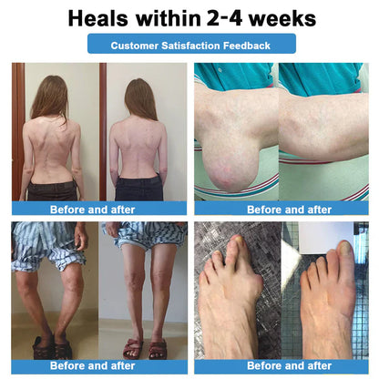 🔥80% OFF - Official Flagship Store: ODALIT™ Nano Microneedle Joint Patch