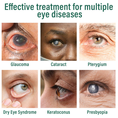 👩‍⚕️LBMLBM® Nano Eye Drops Serum ✅FDA Approved(Suitable for presbyopia, dry eye syndrome, glaucoma, and cataracts) 🌻