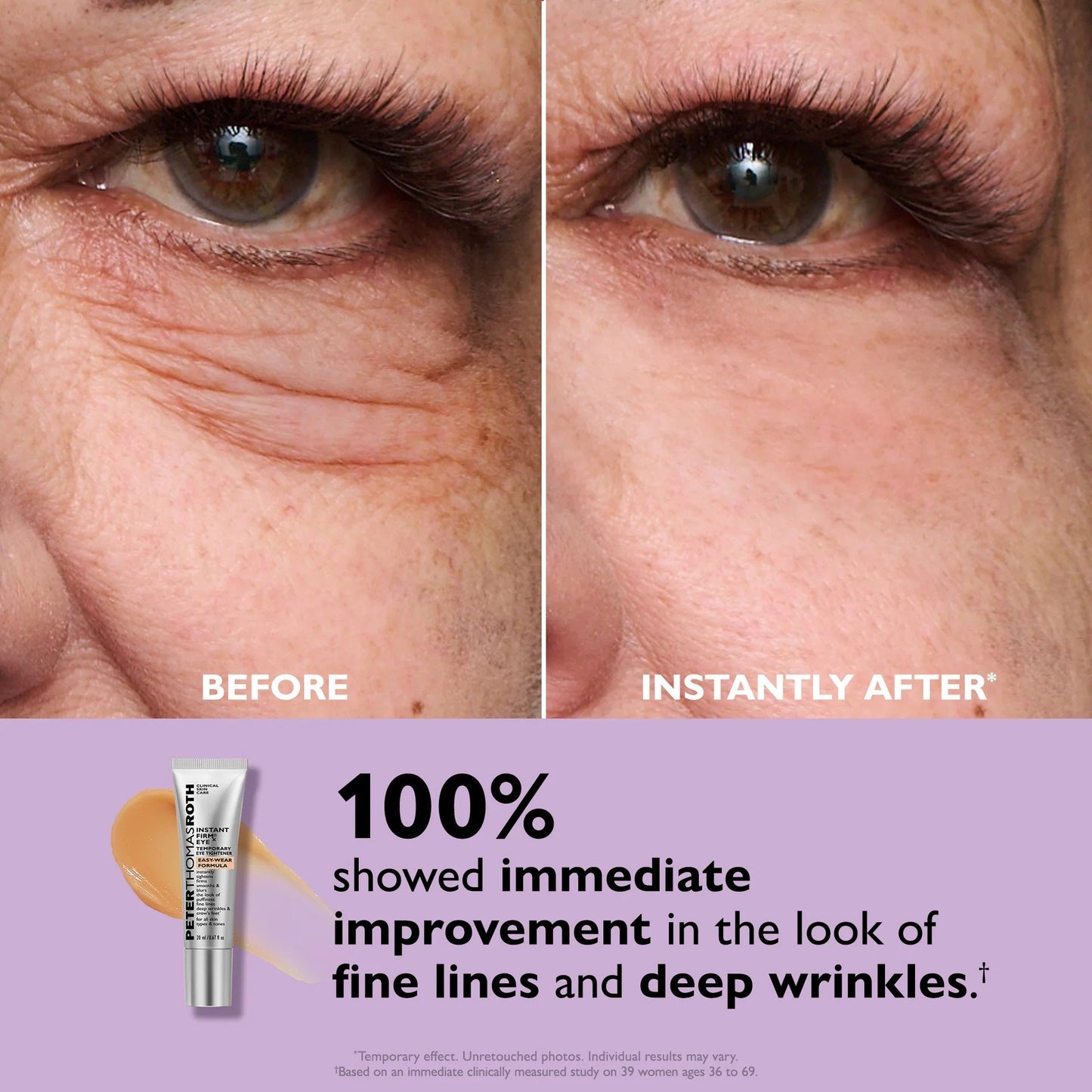💥Last Day 49% OFF 🪄No-Filter Eye Tightener