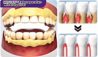 NEGUSY™ Teeth Restoration Mineral Powder🦷(TGA recommended)(🎁Flash Sale - Don’t Miss Out)
