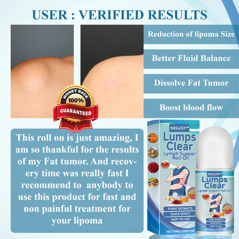 NEGUSY™ Lumps Clear Lymph Support Roll-On