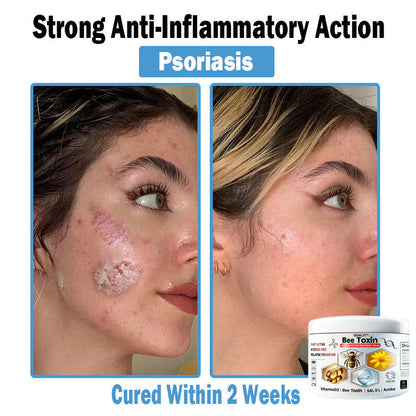 ODALIT™✨ Bee Toxin Multi-Symptom Skin Treatment Cream (👨‍⚕NPF RECOMMENDS)