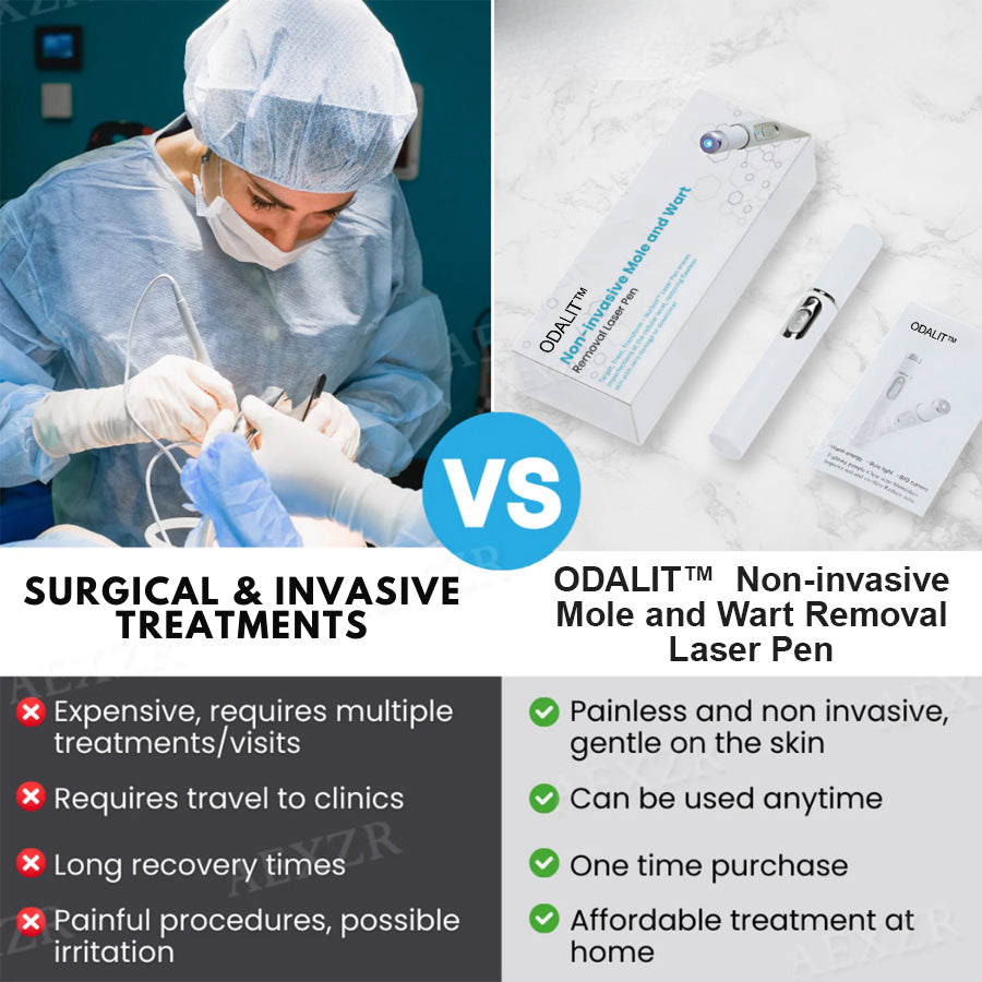 ODALIT™ Non-Invasive Mole and Wart Removal Laser Pen