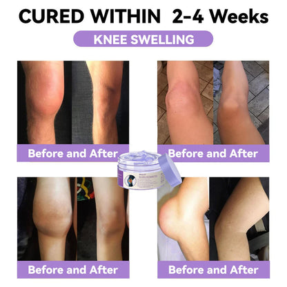 ODALIT™ Arthritis Pain Relief Gel