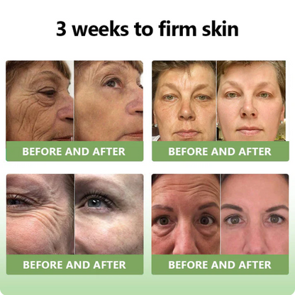 ✅FDA Approval💝JEREMYTIS™ Luxurious Collagen Peptide Firming Cream🔥Limited-Time 70% Off!🔥