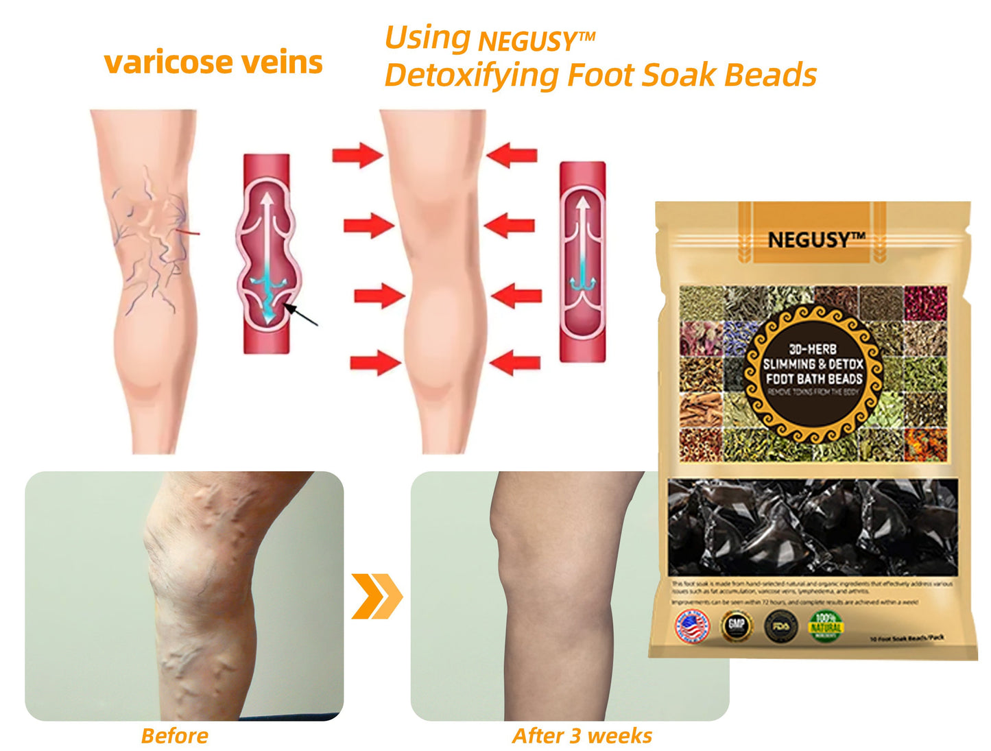 NEGUSY™ 30-Herb Slimming & Detox Foot Bath Beads-🦵