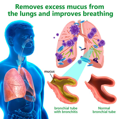 Official Store: Cvreoz™ 𝗠𝘂𝗹𝗹𝗲𝗶𝗻 𝗖𝗹𝗲𝗮𝗿 𝗟𝘂𝗻𝗴 𝗥𝗲𝗽𝗮𝗶𝗿 𝗖𝗿𝗲𝗮𝗺 - American Thoracic Society Endorsed to Support Lung Health👑