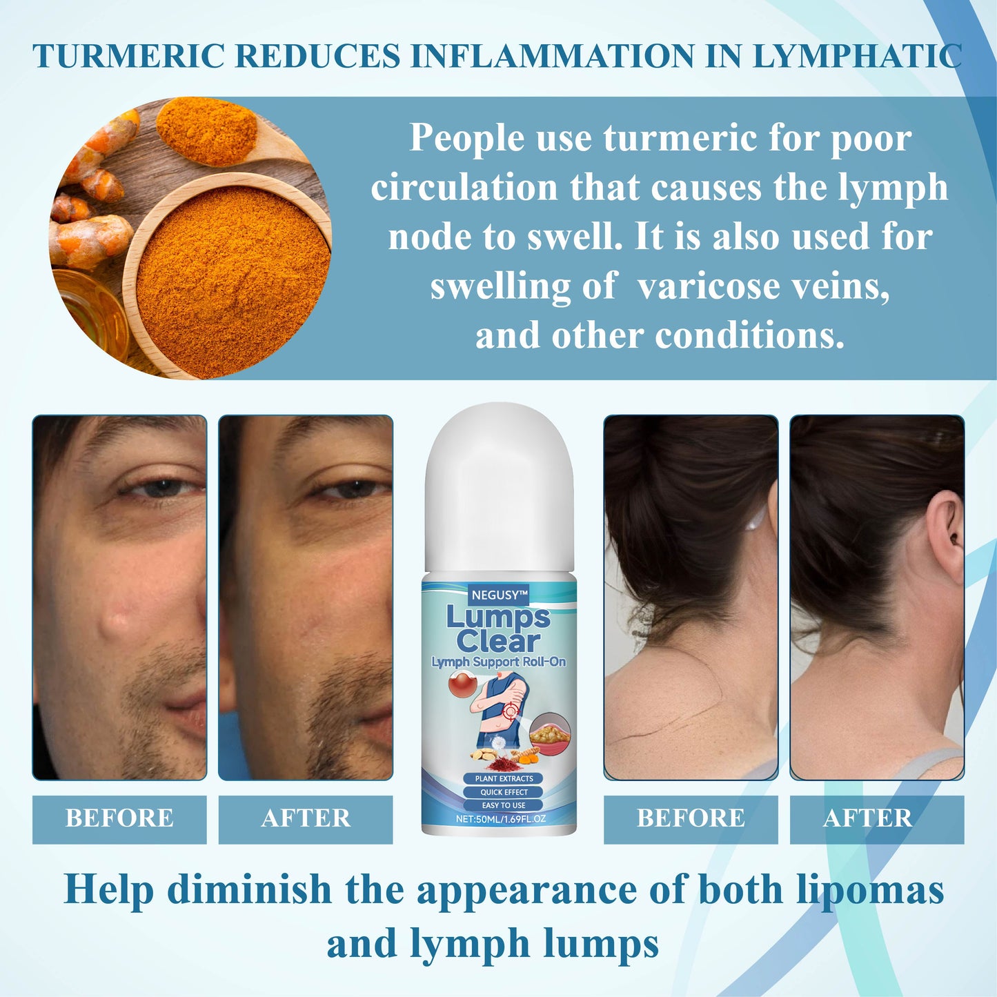 NEGUSY™ Lumps Clear Lymph Support Roll-On