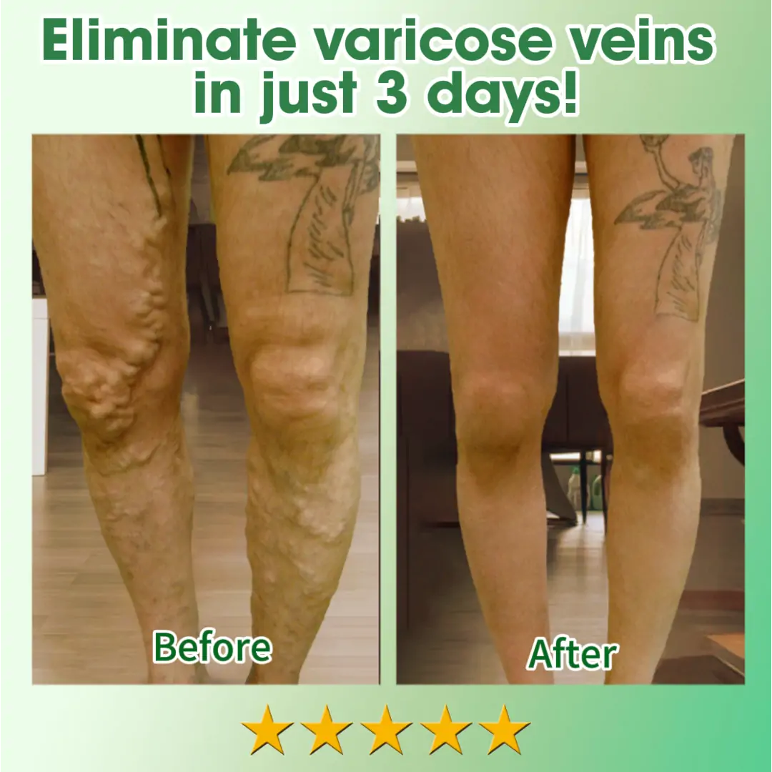 JEREMYTIS™ 30 Herbal Firming Slimming & Detox Foot Bath Beads 🌿