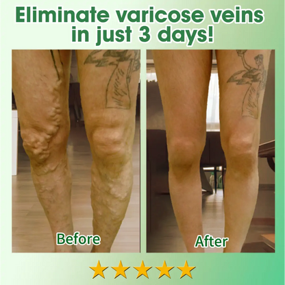 JEREMYTIS™ 30 Herbal Firming Slimming & Detox Foot Bath Beads 🌿