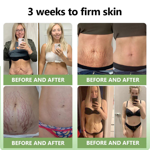 ✅FDA Approval💝JEREMYTIS™ Luxurious Collagen Peptide Firming Cream🔥Limited-Time 70% Off!🔥