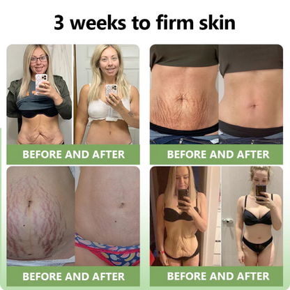 ✅FDA Approval💝JEREMYTIS™ Luxurious Collagen Peptide Firming Cream🔥Limited-Time 70% Off!🔥