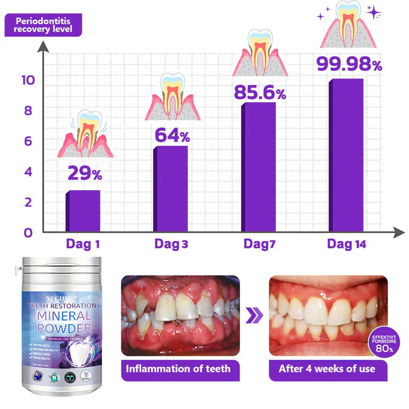 NEGUSY™ Teeth Restoration Mineral Powder🦷(TGA recommended)(🎁Flash Sale - Don’t Miss Out)