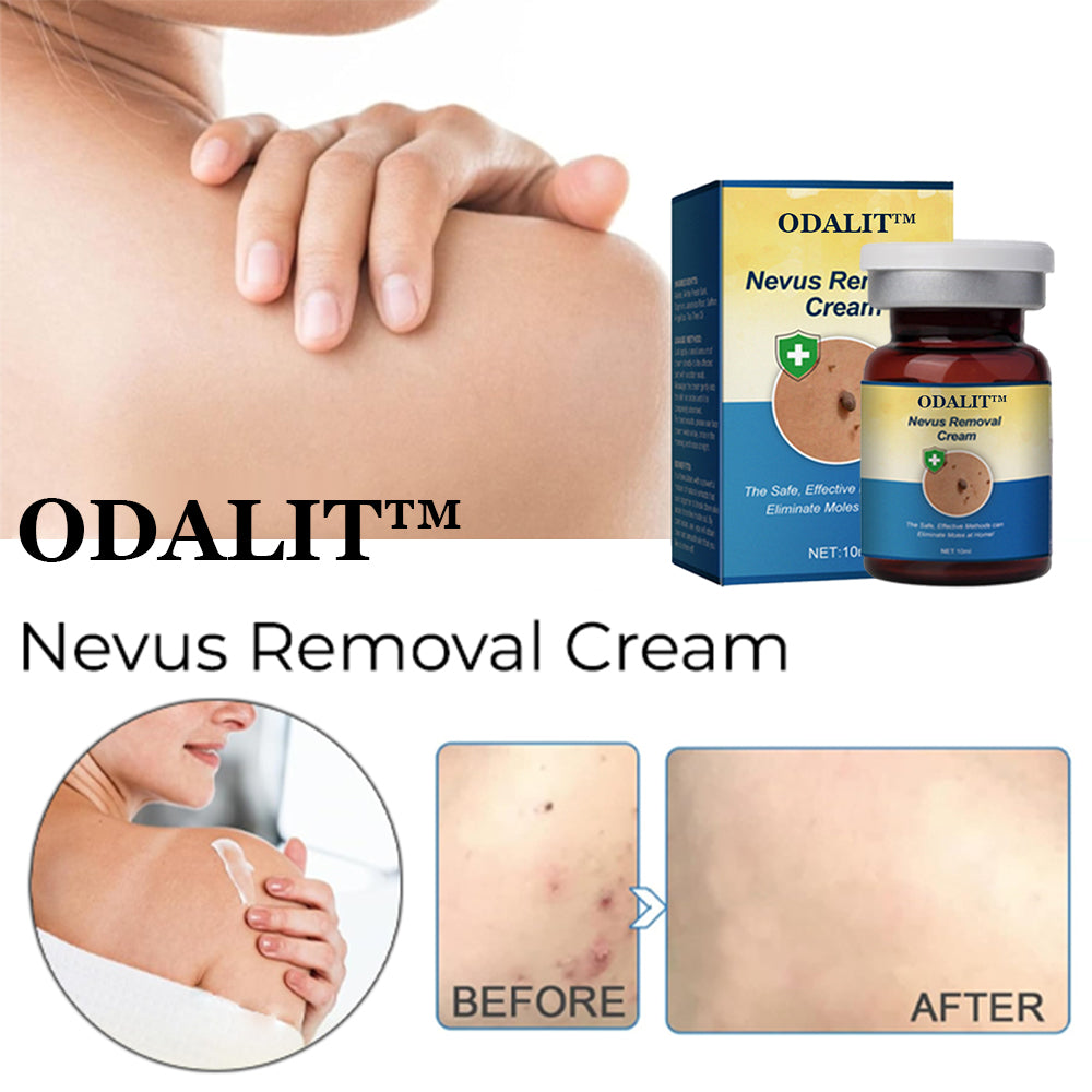 ✅Official Store:ODALIT™ Nevus Removal Cream