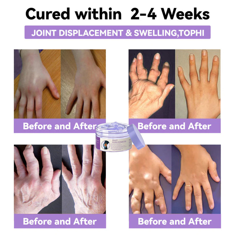 ODALIT™ Arthritis Pain Relief Gel