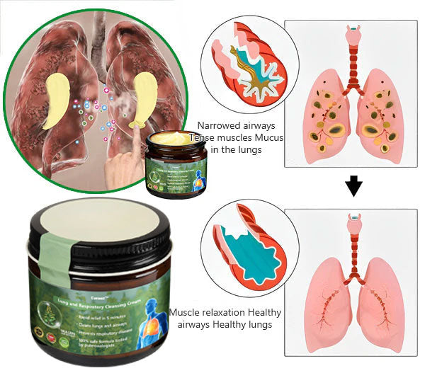 Official Store: Cvreoz™ 𝗠𝘂𝗹𝗹𝗲𝗶𝗻 𝗖𝗹𝗲𝗮𝗿 𝗟𝘂𝗻𝗴 𝗥𝗲𝗽𝗮𝗶𝗿 𝗖𝗿𝗲𝗮𝗺 - American Thoracic Society Endorsed to Support Lung Health👑