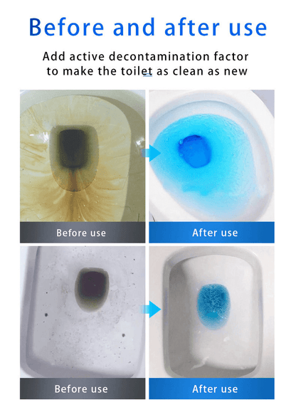 🔥 50% OFF💕SINK & DRAIN CLEANER🔥Buy2 Get 1 Free