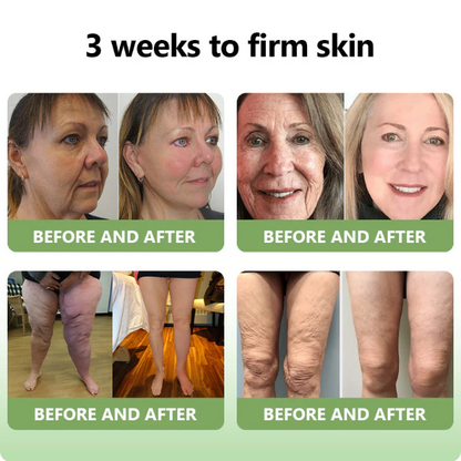 ✅FDA Approval💝JEREMYTIS™ Luxurious Collagen Peptide Firming Cream🔥Limited-Time 70% Off!🔥
