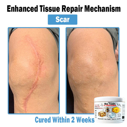 ODALIT™✨ Bee Toxin Multi-Symptom Skin Treatment Cream (👨‍⚕NPF RECOMMENDS)