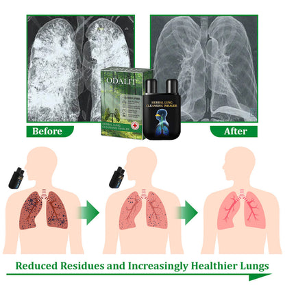 ✅Official Store: ODALIT™ Herbal Lung Cleansing Inhaler