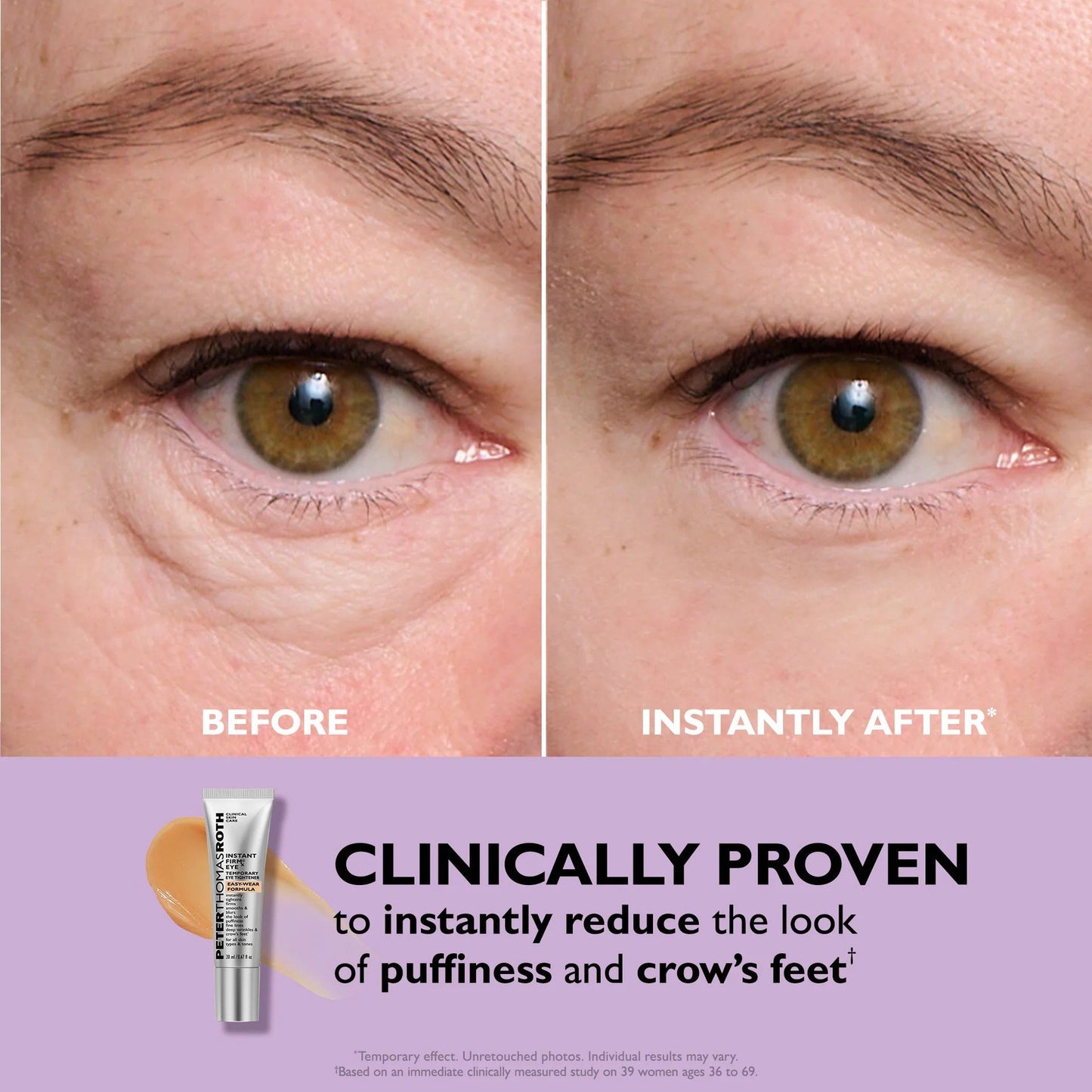 💥Last Day 49% OFF 🪄No-Filter Eye Tightener