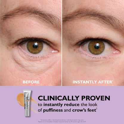 💥Last Day 49% OFF 🪄No-Filter Eye Tightener