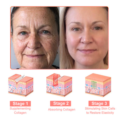 NEGUSY™ Collagen Jelly Cream