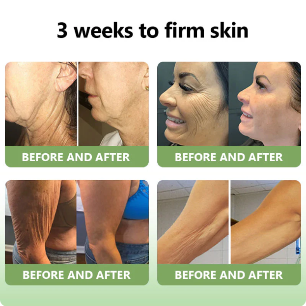 ✅FDA Approval💝JEREMYTIS™ Luxurious Collagen Peptide Firming Cream🔥Limited-Time 70% Off!🔥