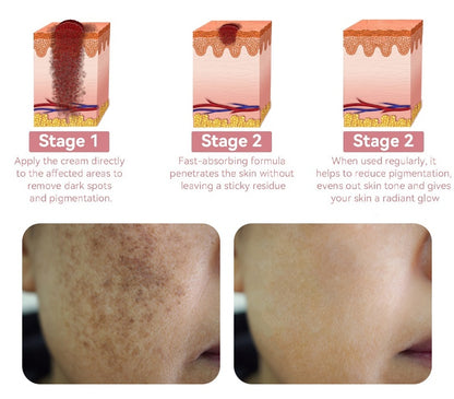 NEGUSY™ Collagen Jelly Cream