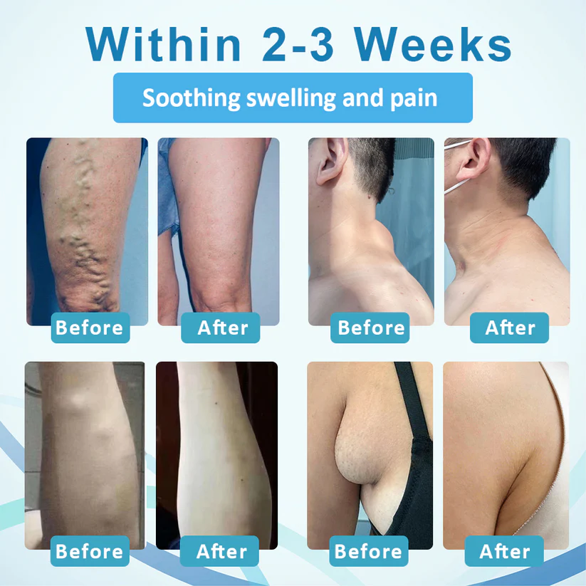 NEGUSY™ Lumps Clear Lymph Support Roll-On