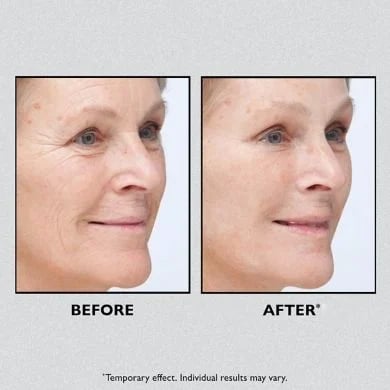 🎉Hot Sale 49% OFF🎉 Temporary Face Tightener